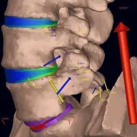 Spine Research Institute, The Ohio State University